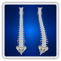 Scoliosis treatment in Whittier CA
